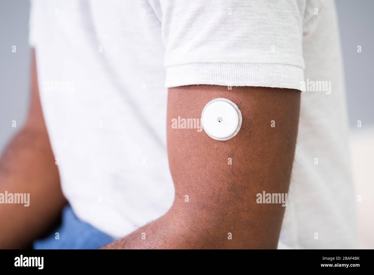 Close-up Of A Man Testing Glucose Level With A Continuous Glucose Monitor On His Arm Stock Photo