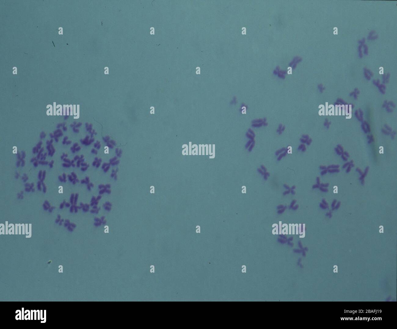 Human chromosomes set hi-res stock photography and images - Alamy