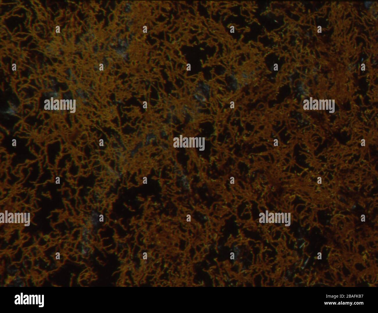 Dark field microscopy cells hi-res stock photography and images - Alamy