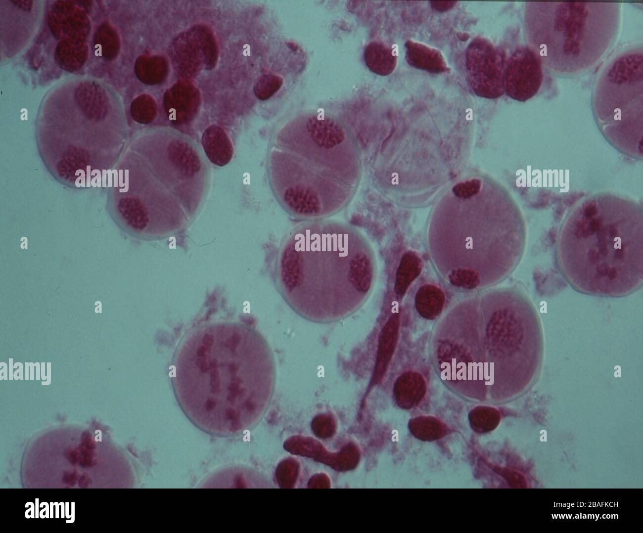 Human chromosomes hi-res stock photography and images - Alamy