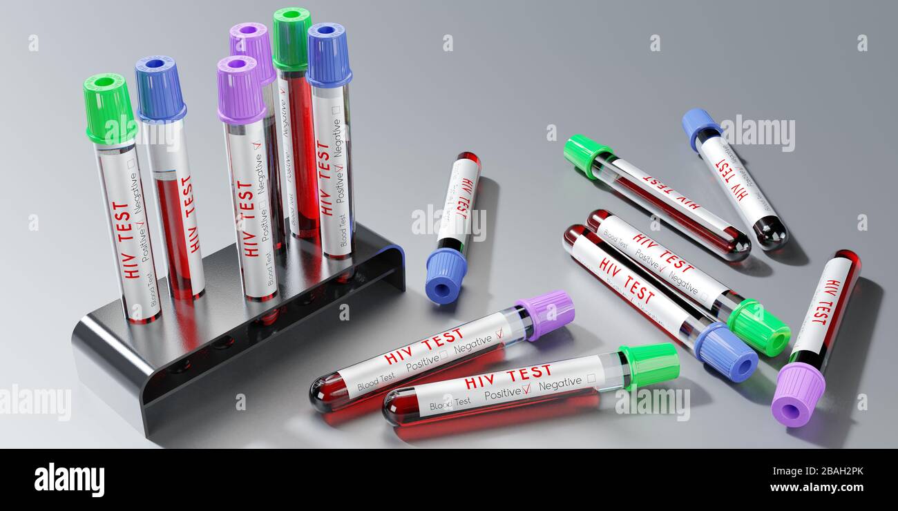 Positive hiv blood test hires stock photography and images Alamy