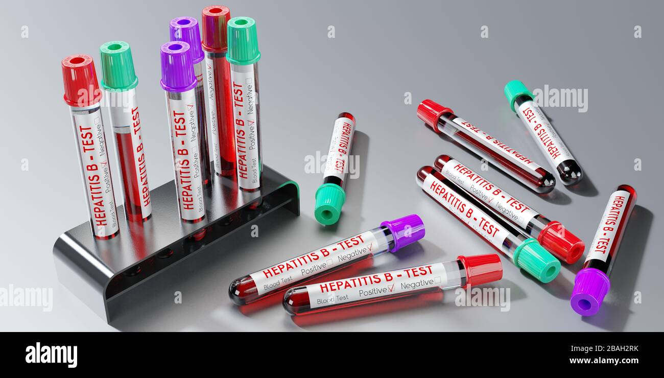 Hepatitis B virus - test tubes, blood tests - 3D illustration Stock Photo