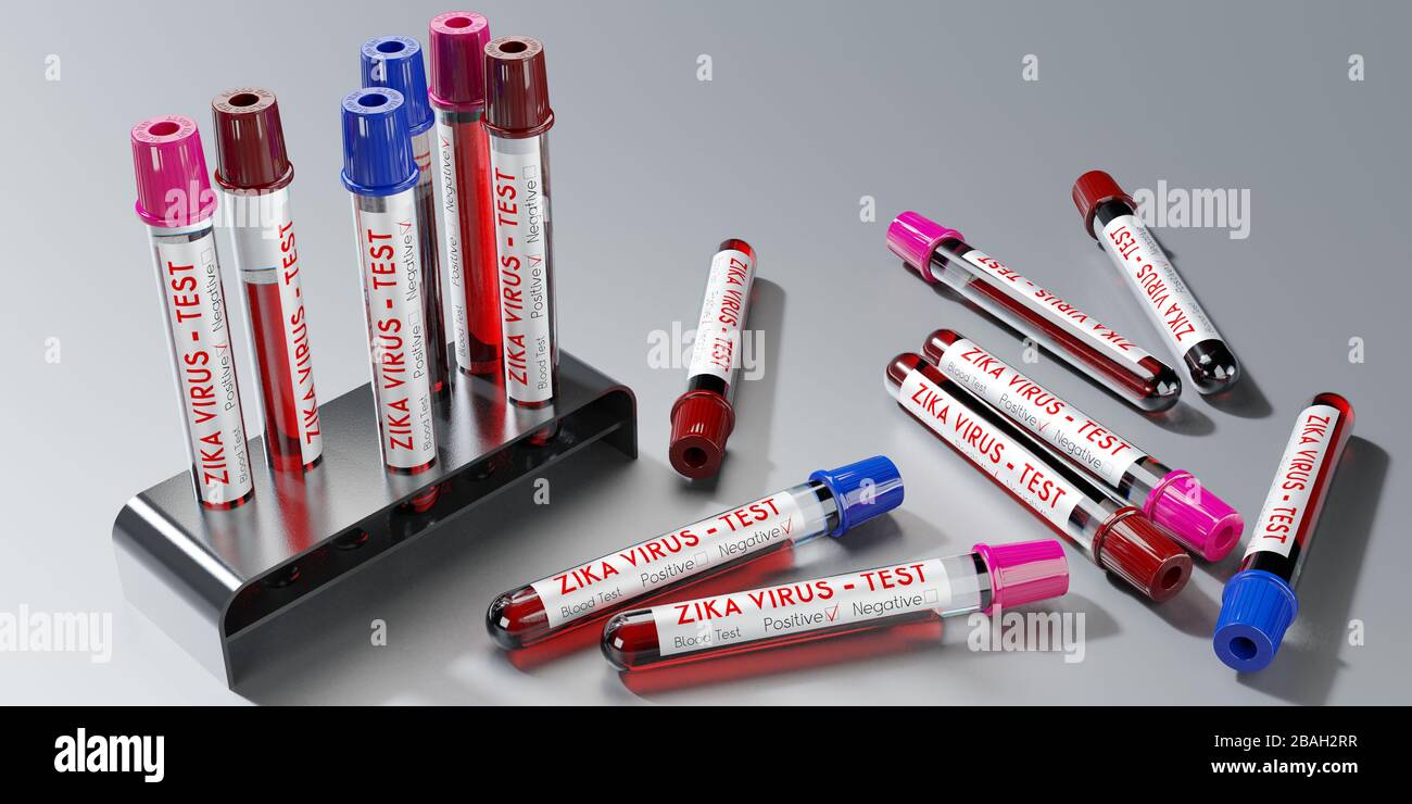 ZIKA virus - test tubes, blood tests - 3D illustration Stock Photo - Alamy