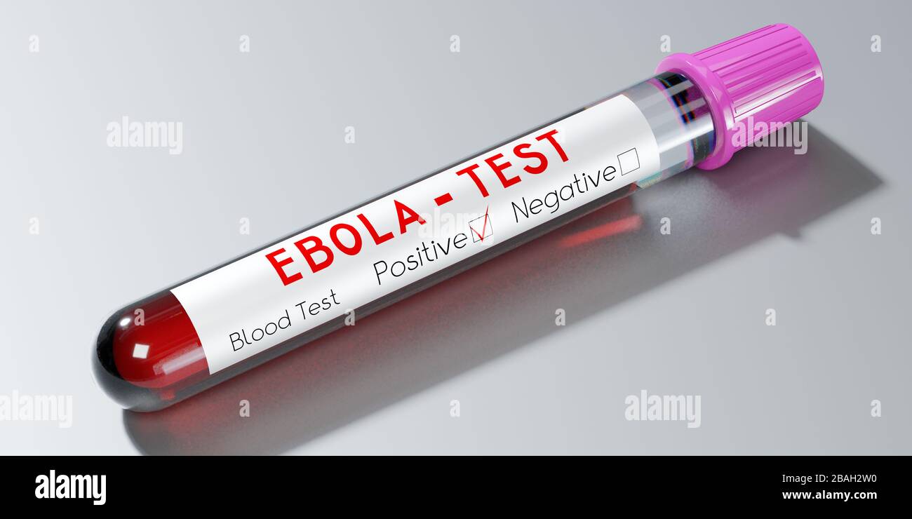 Ebola virus - test tube, blood test - 3D illustration Stock Photo - Alamy