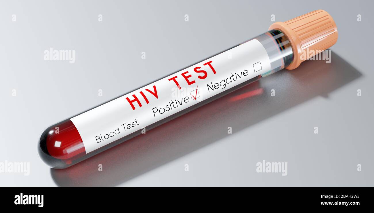 Hiv negative hires stock photography and images Alamy