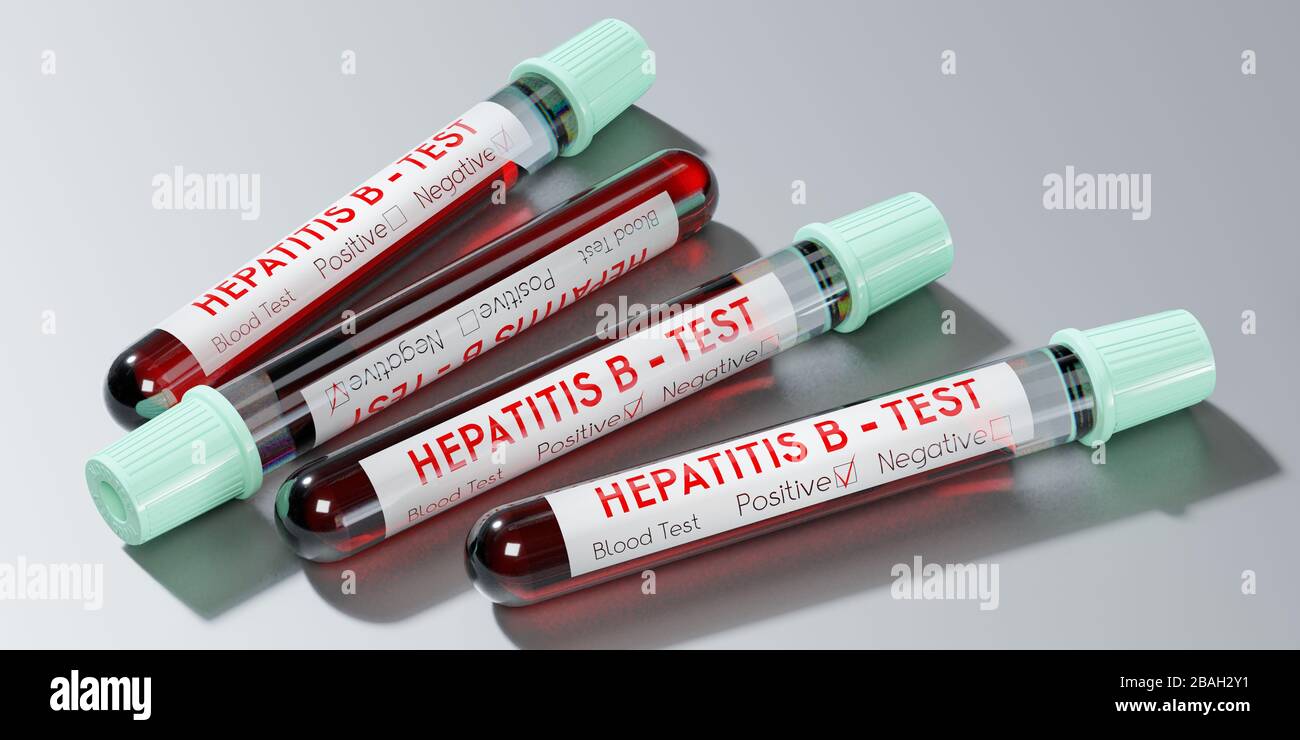 Hepatitis B virus test tubes, blood tests 3D illustration Stock Photo Alamy