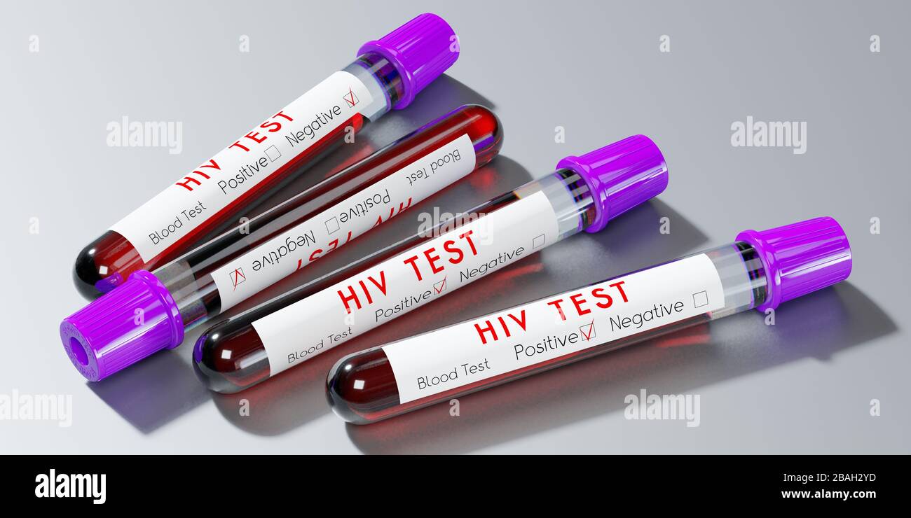 HIV virus/ AIDS test tubes, blood tests 3D illustration Stock Photo
