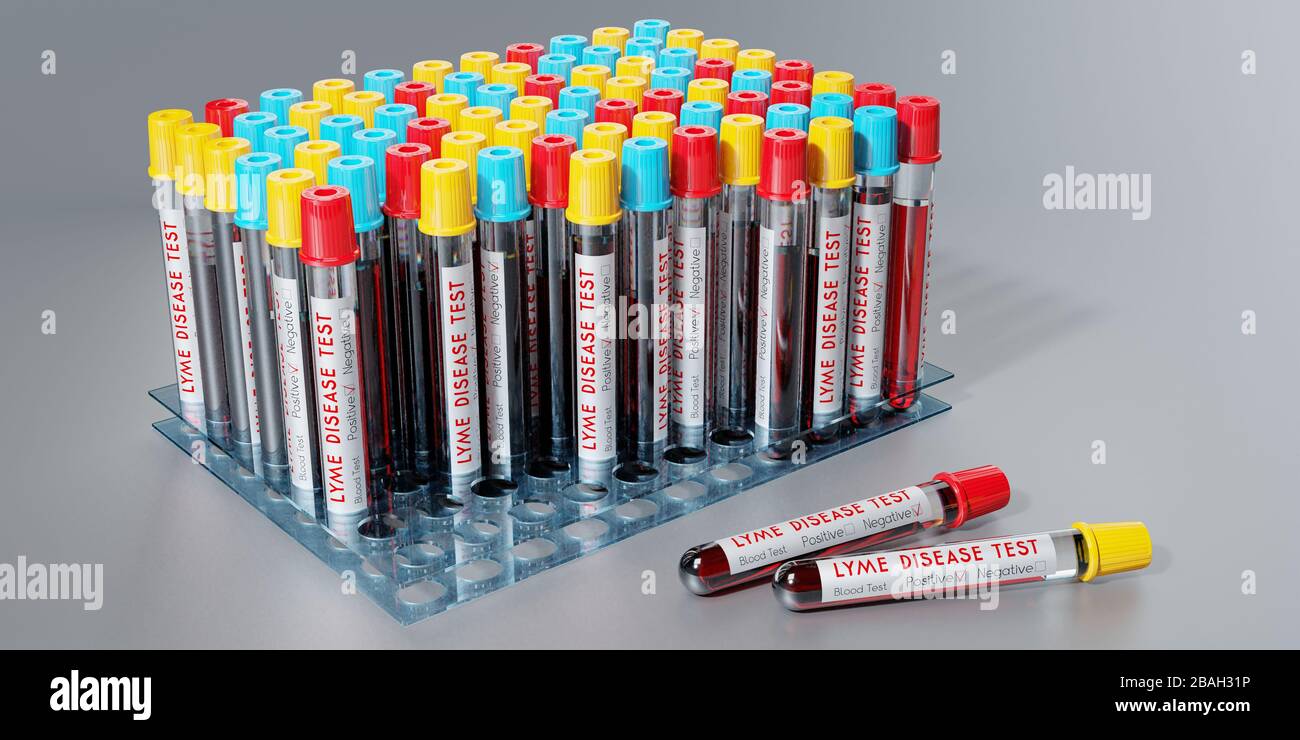 Lyme disease virus test tubes, blood tests 3D illustration Stock