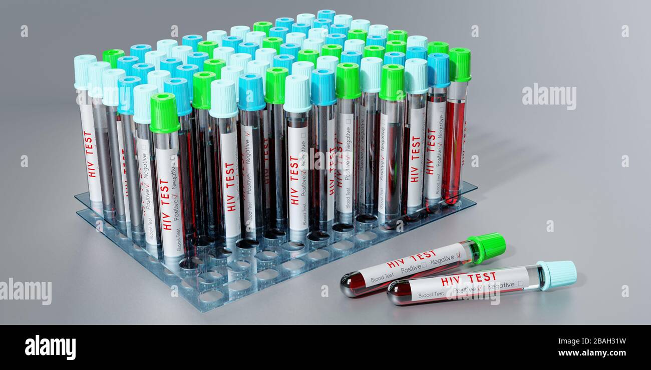 HIV virus/ AIDS test tubes, blood tests 3D illustration Stock Photo