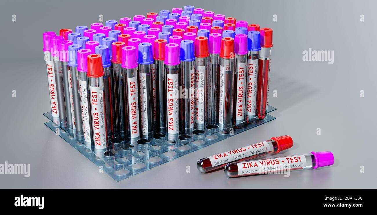 ZIKA virus - test tubes, blood tests - 3D illustration Stock Photo - Alamy