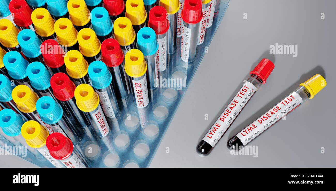 Lyme disease virus test tubes, blood tests 3D illustration Stock