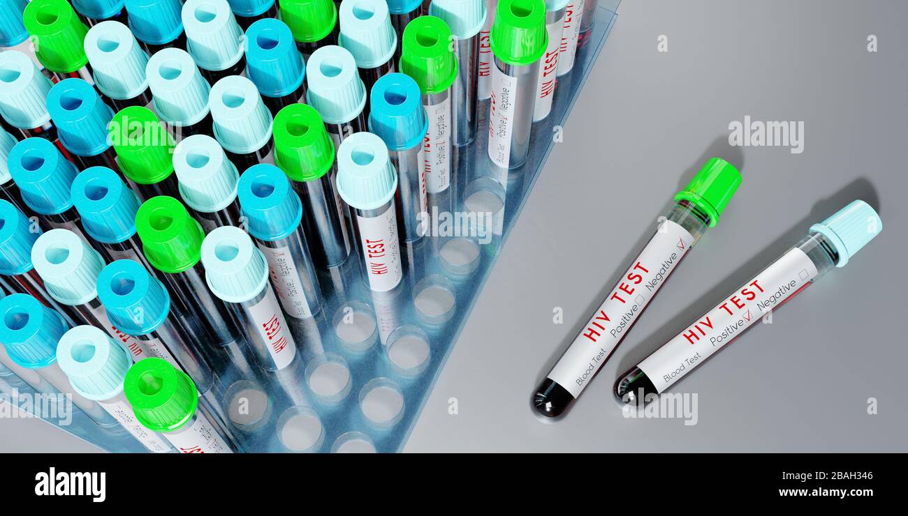 HIV virus/ AIDS test tubes, blood tests 3D illustration Stock Photo