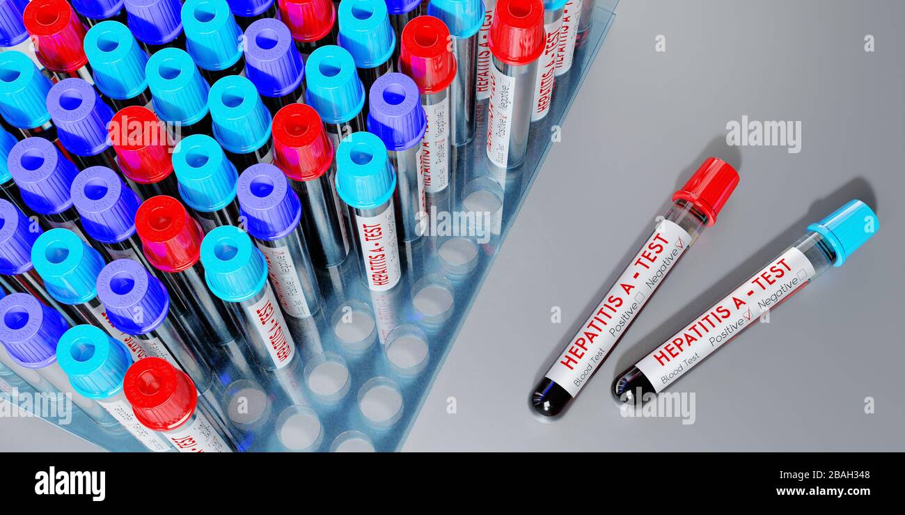 Hepatitis A virus - test tubes, blood tests - 3D illustration Stock Photo -  Alamy