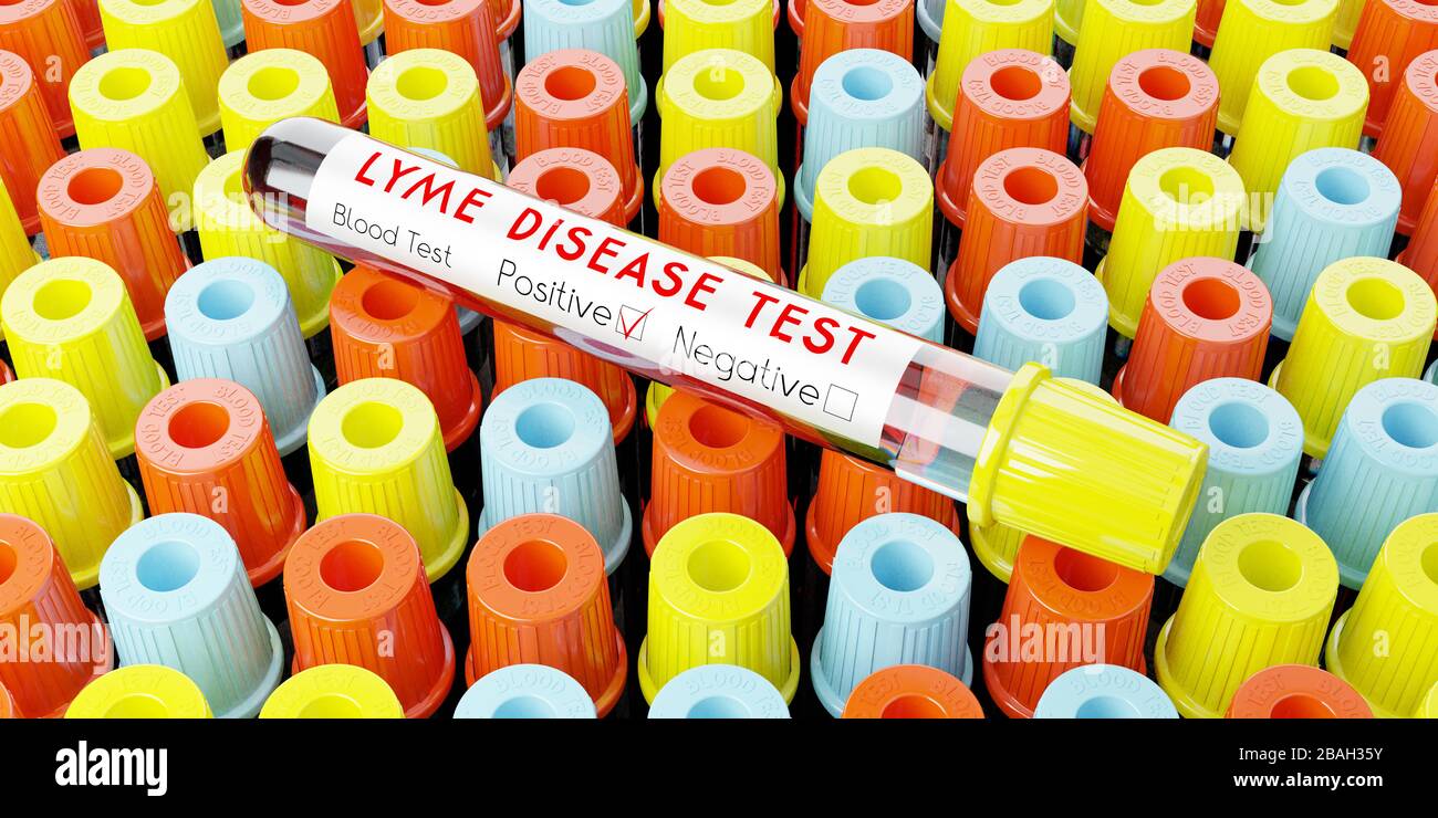 Lyme disease virus test tubes, blood tests 3D illustration Stock Photo Alamy