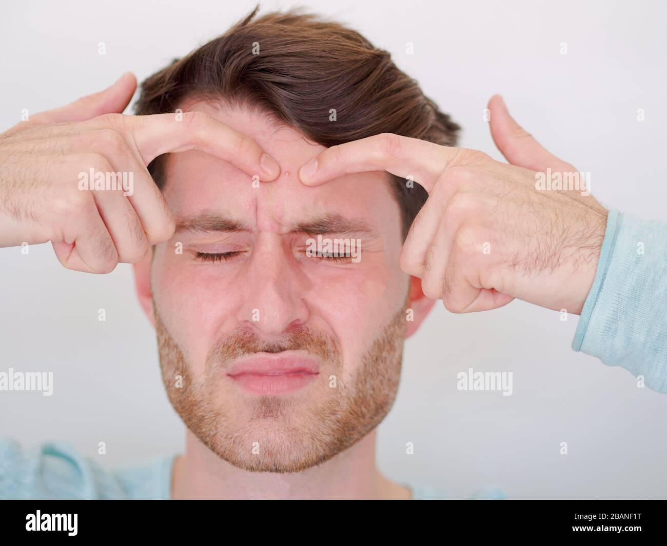 Pimples on the forehead hires stock photography and images Alamy