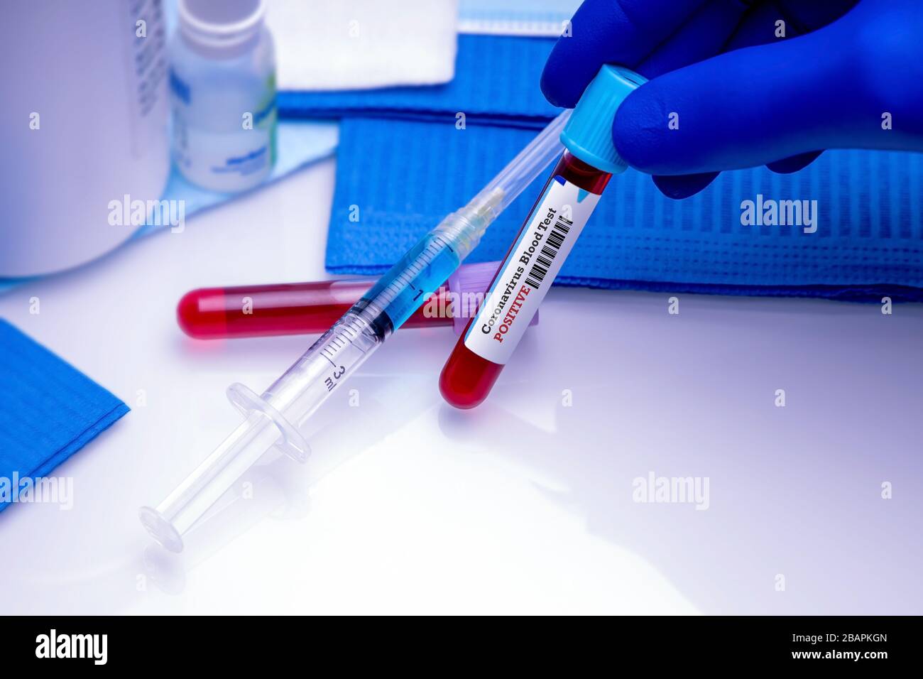 Positive Coronavirus Sample Blood Test testing for Dangerous COVID-19 Virus Global Pandemic 2019-nCoV Atypical Pneumonia Infection concept. Stock Photo