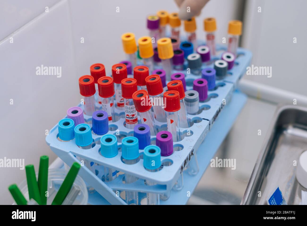 Closeup of medical blood tube for blood collection with vacuum capsule Stock Photo Alamy