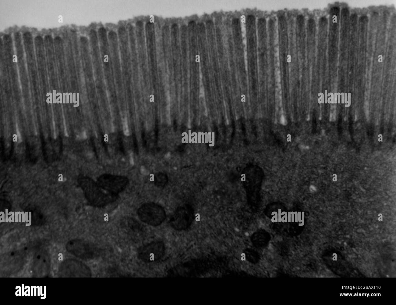 'English: Transmission electron microscope image of a thin section cut through a human jejunum (segment of small intestine) epithelial cell. Image shows apical end of absorptive cell with some of the densely packed microvilli that make up the striated border. Each microvillus is approximately 1um long by 0.1um in diameter and contains a core of actin microfilaments.; http://remf.dartmouth.edu/images/humanMicrovilliTEM/source/1.html; Louisa Howard, Katherine Connollly - Dartmouth Electron Microscope Facility; ' Stock Photo