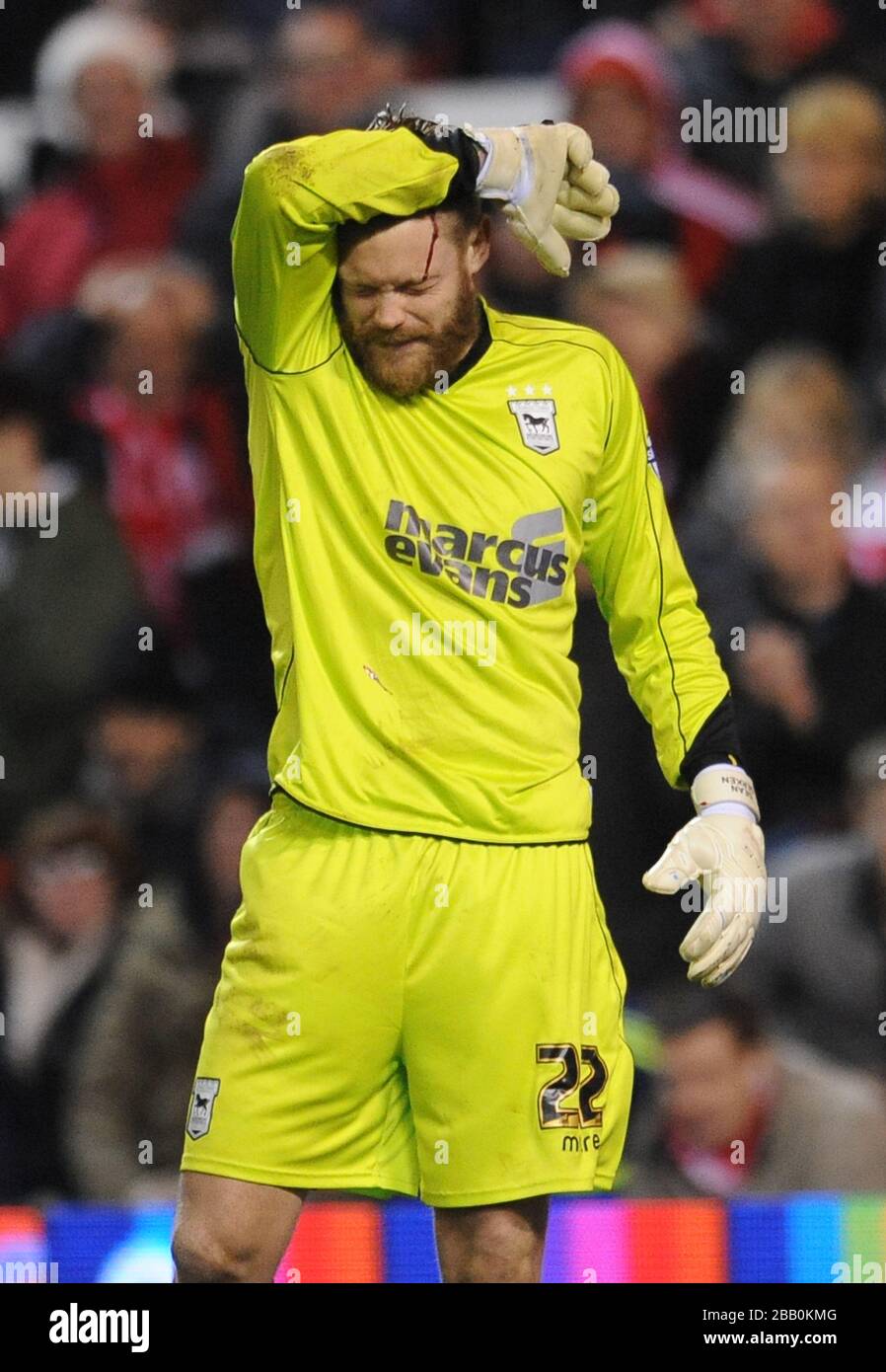 Ipswich Town goalkeeper Dean Gerken with a cut to his head after making a save to deny Nottingham Forest's Simon Cox Stock Photo