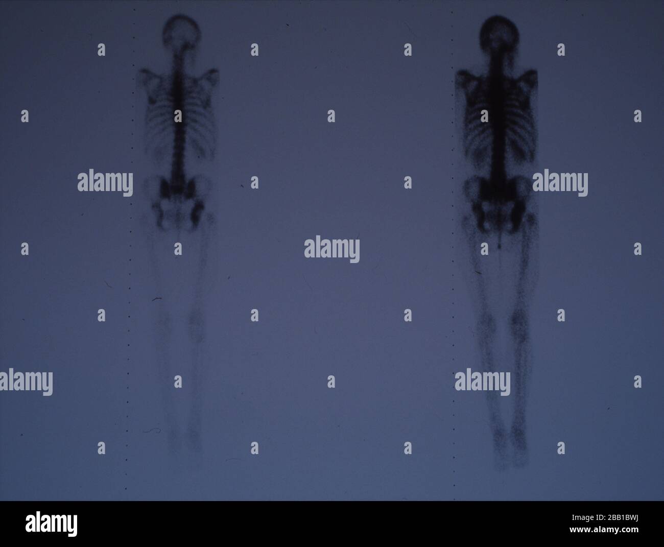 Whole body xray image for medical diagnosis Stock Photo Alamy