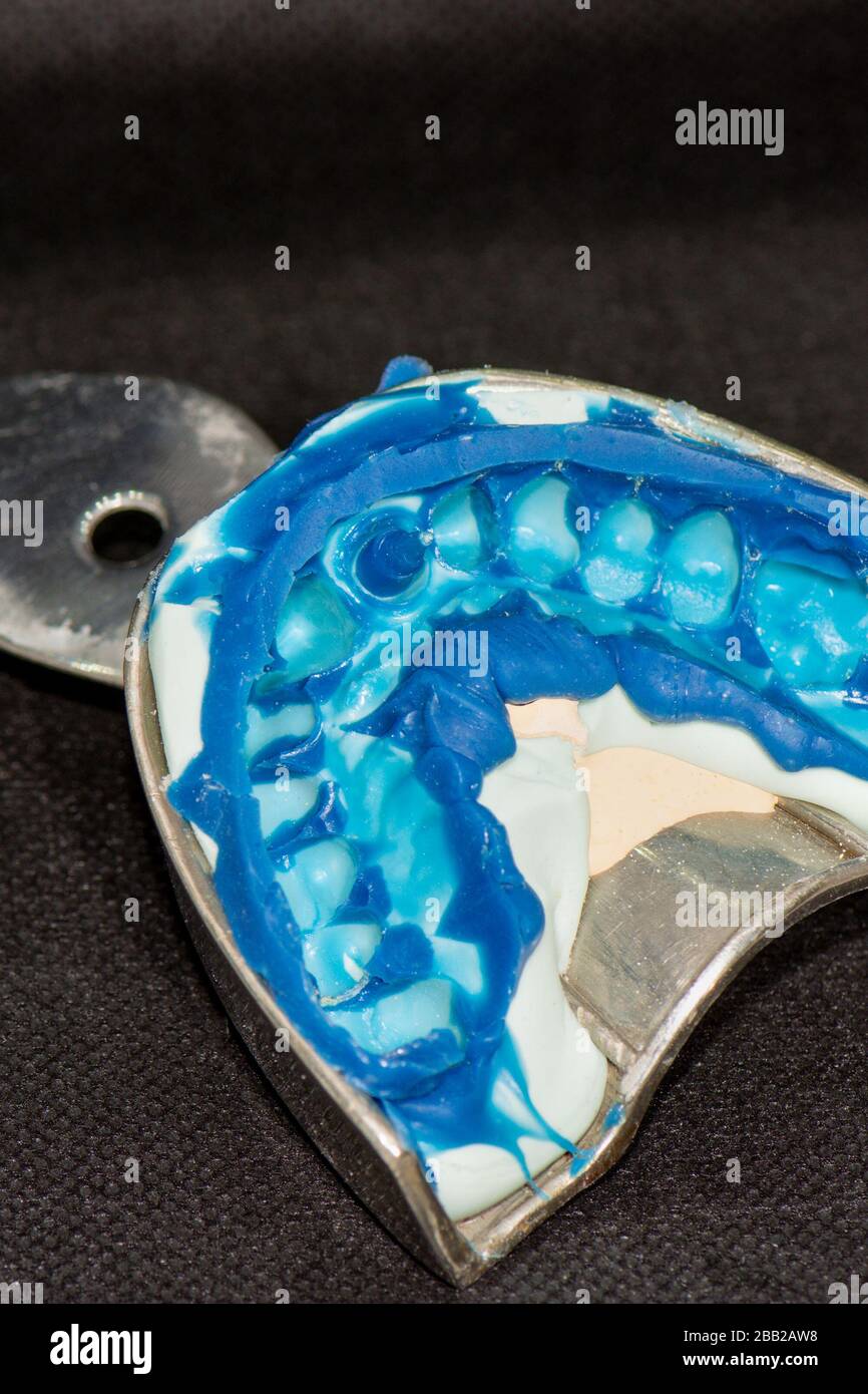 silicone imprint of human teeth close-up. manufacture of dental crowns and root pins. Stock Photo