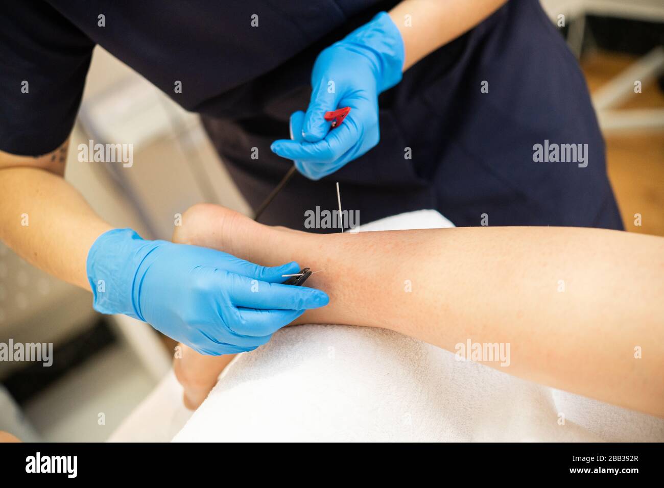 Electroacupuncture dry with needle connecting machine Stock Photo Alamy