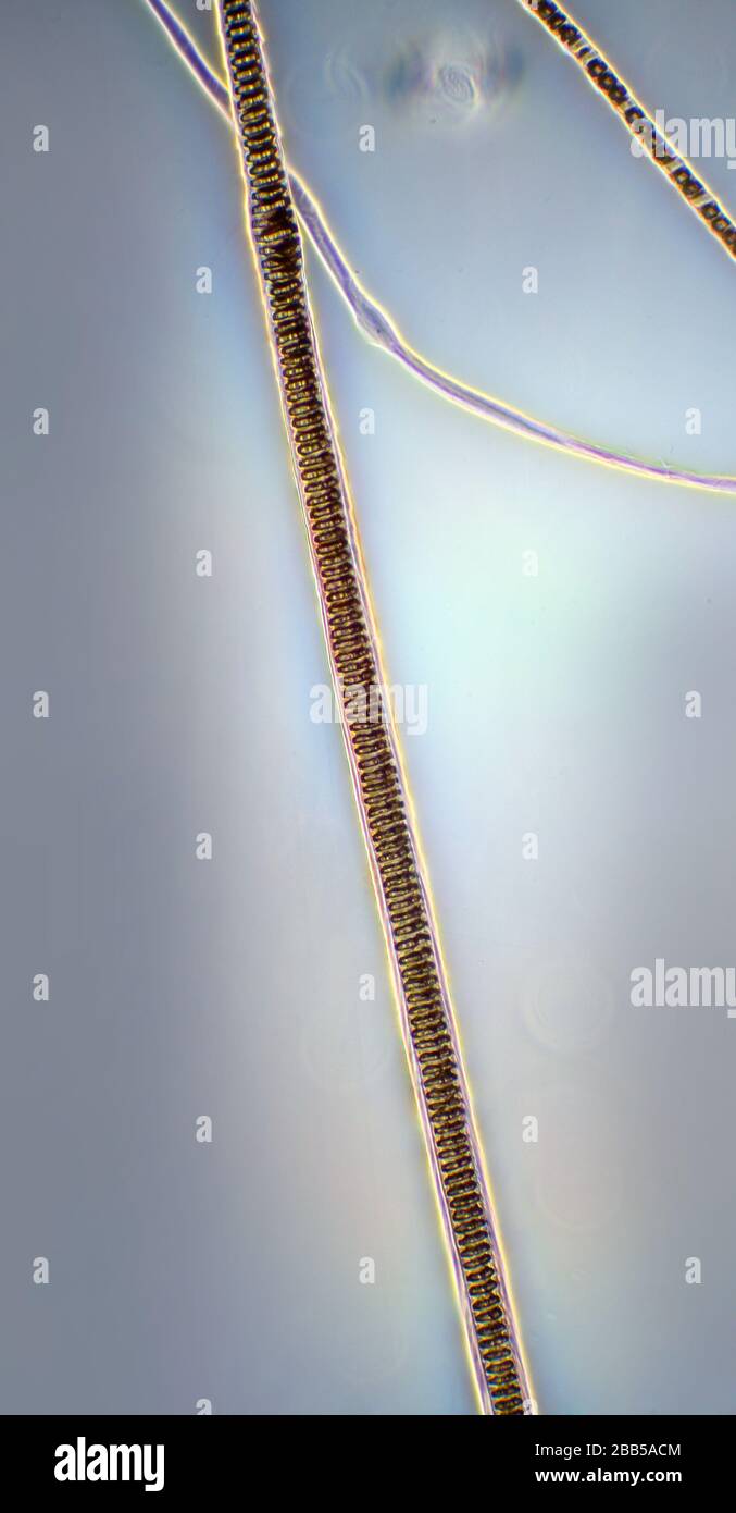 Micrograph hair hi-res stock photography and images - Alamy