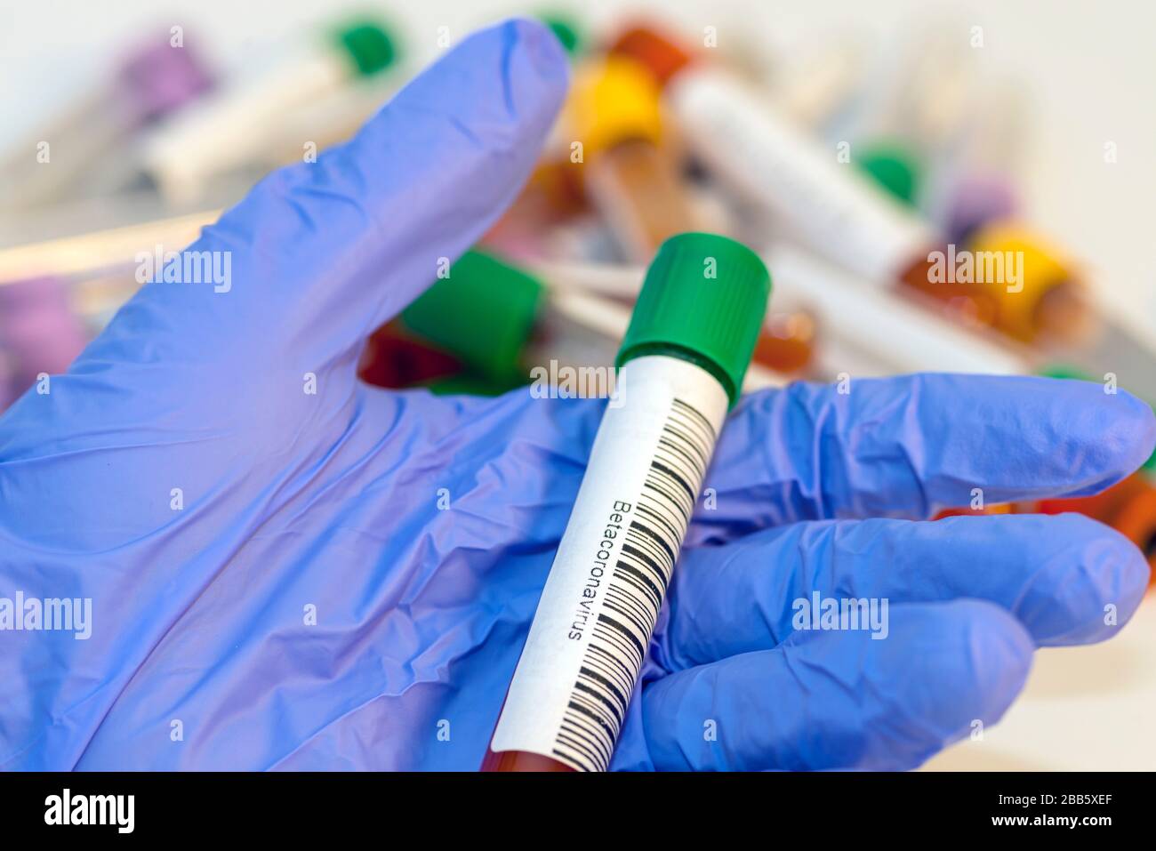 The attendant holds the blood test tube in his hand for corovirus Stock ...