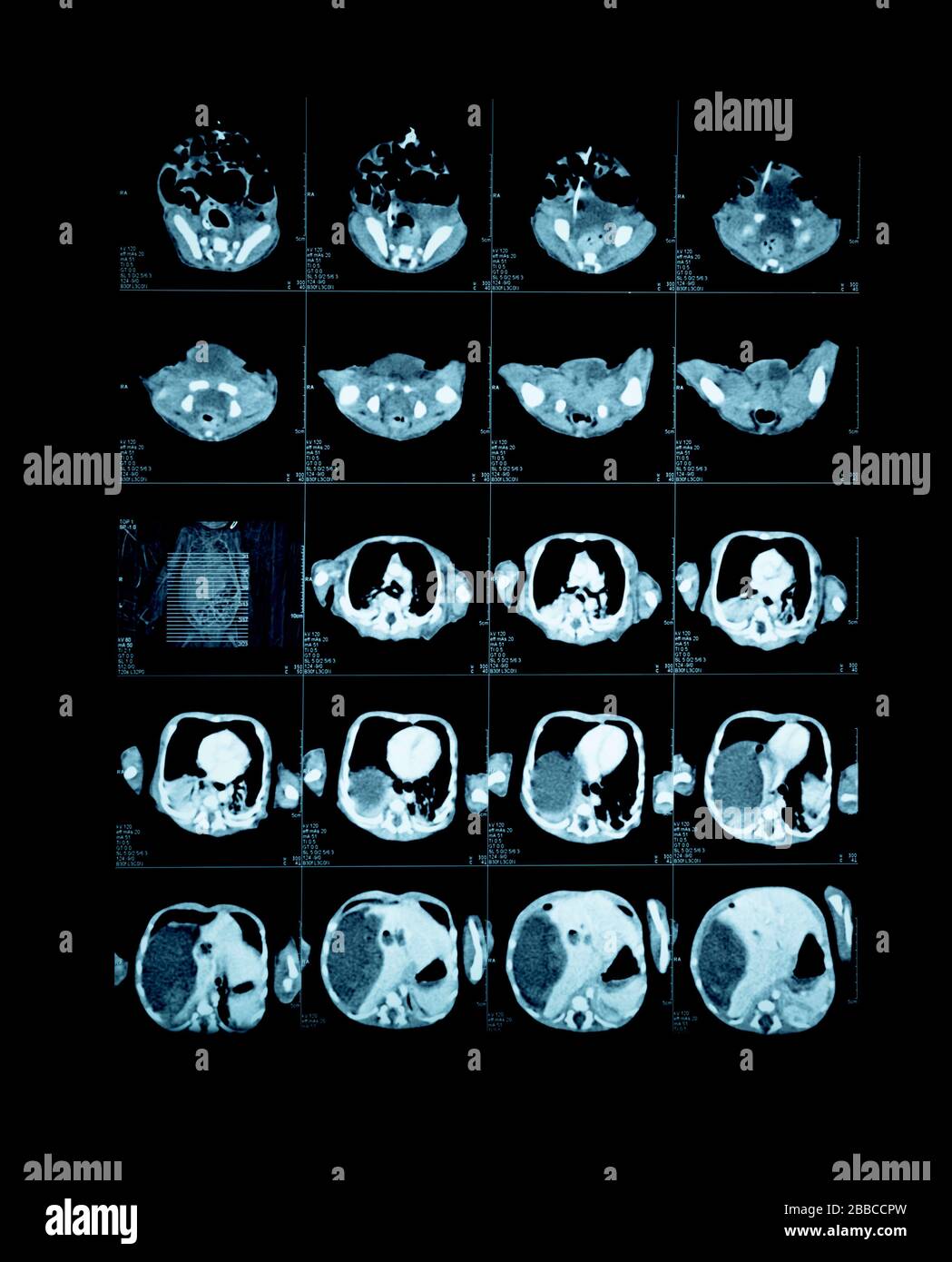Magnetic resonance image (MRI) of the child brain. Stock Photo