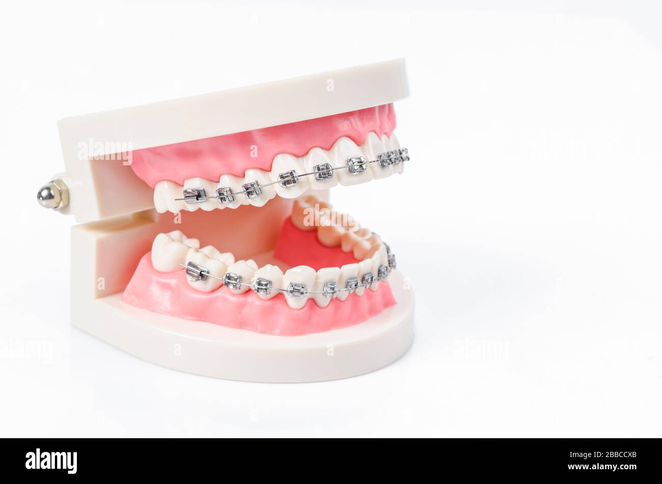 tooth model with metal wire dental braces isolated on white background