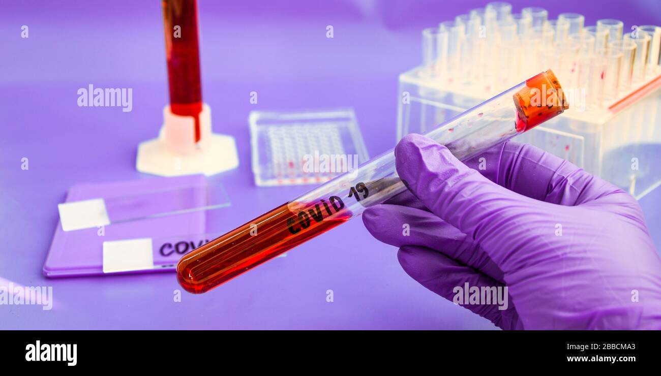 Coronavirus Blood Sample, DNA testing of the blood in the laboratory