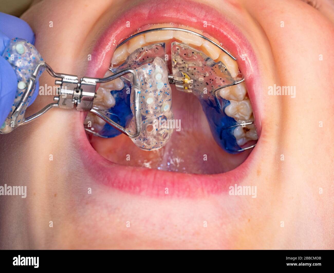 Miroir dentaire en gros plan dans la bouche.Macro photographie du processus  d'examen des dents Photo Stock - Alamy