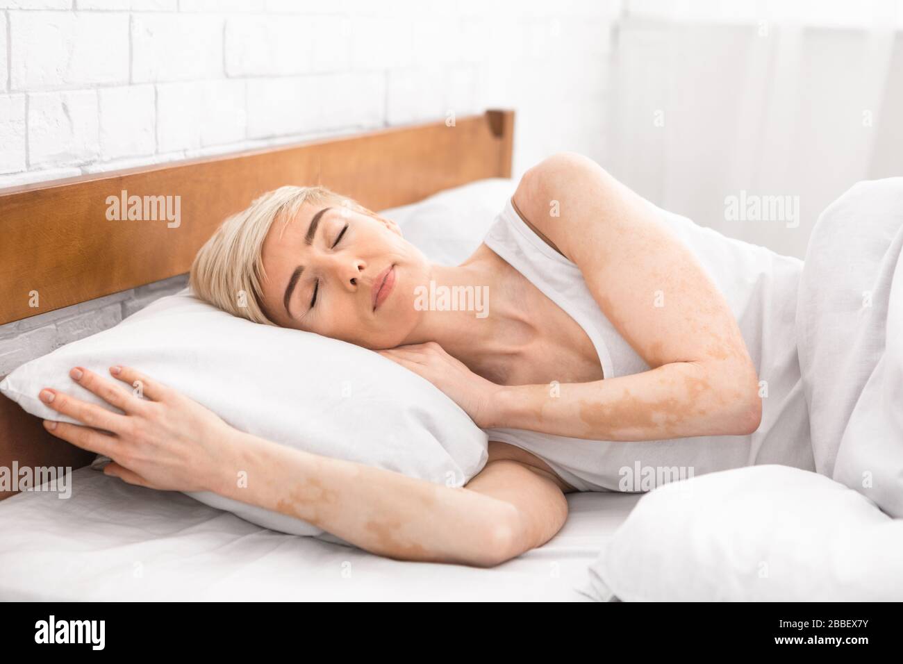 Portrait of mature sleeping lady with vitiligo disease Stock Photo