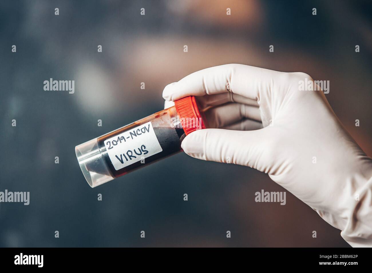 Doctor, laborant holding ampoule of blood with potential koronavirus infection Stock Photo
