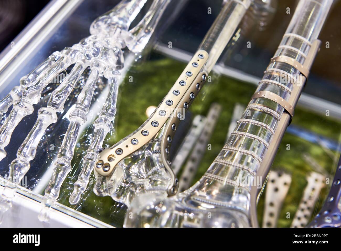 Titanium plates for splicing bones on exhibition Stock Photo