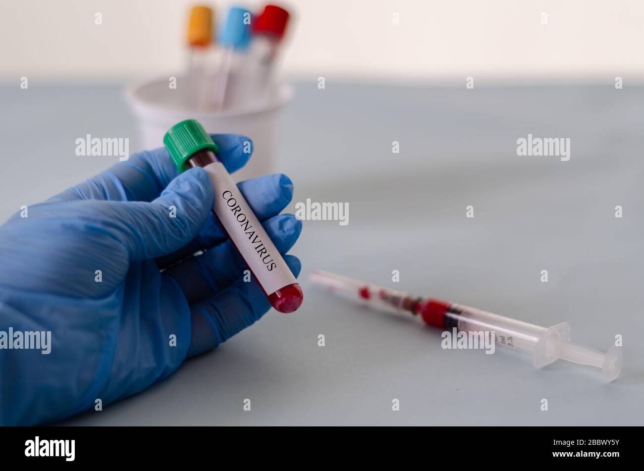 Blood test tubes in the lab,Blood samples, covid19 test blood sample, conceptual image Stock