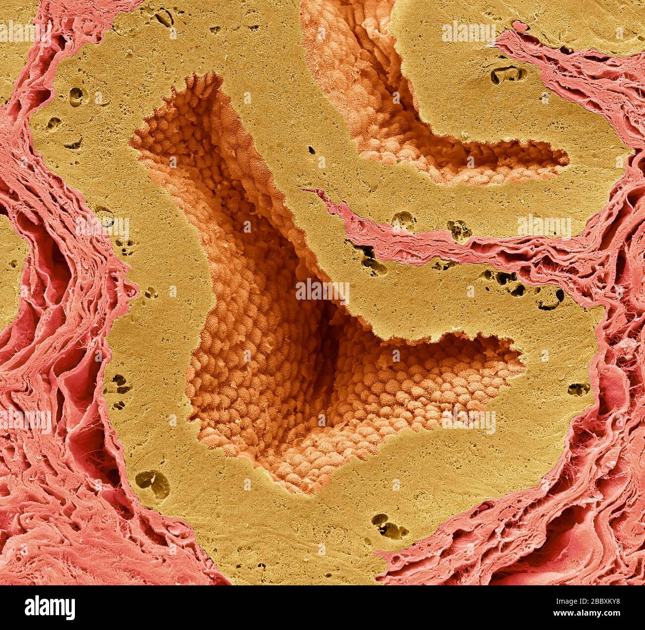 Human Prostate Coloured Scanning Electron Micrograph Sem Of A Section Through The Prostate The Prostate Is A Small Gland Found Only In Men It S About The Size Of A Walnut And Gets<script async src=