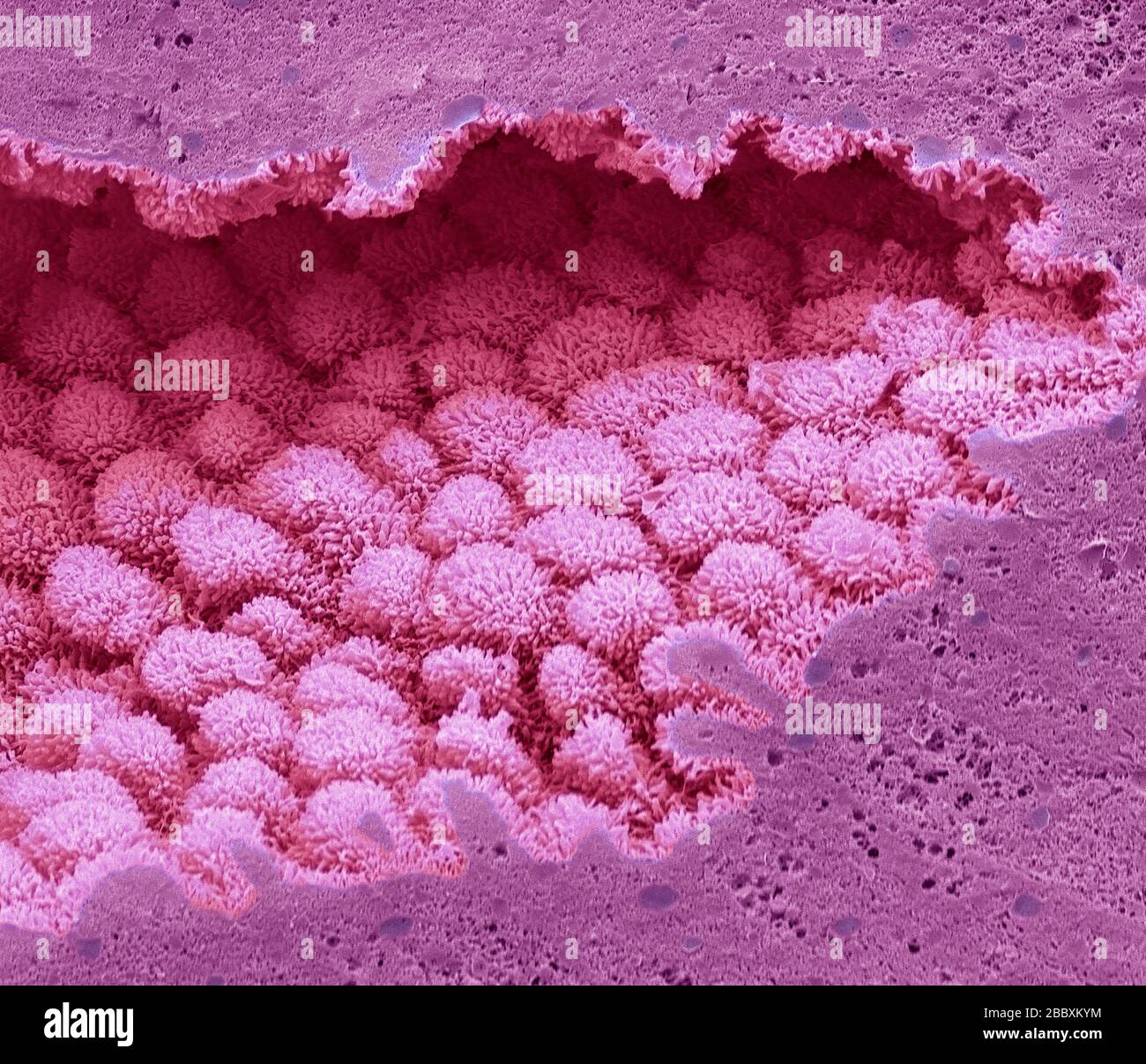 Human Prostate Coloured Scanning Electron Micrograph Sem Of A Section Through The Prostate The Prostate Is A Small Gland Found Only In Men It S About The Size Of A Walnut And Gets<script async src=