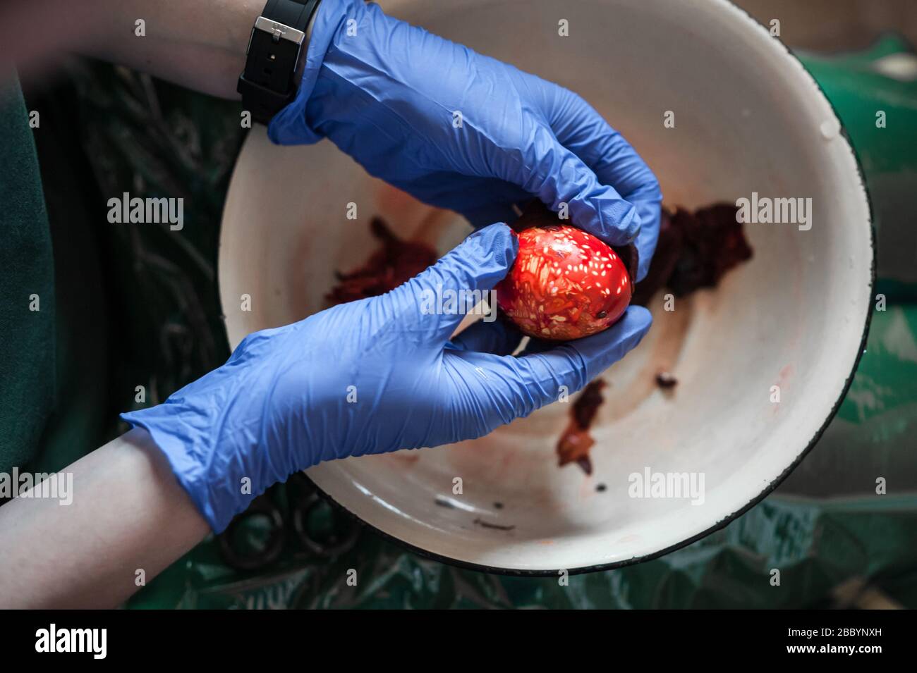 A hard boiled Easter egg that has been boiled in dye with onion skin and linseed to create beautiful and unique patterns, is unwrapped from gauze. Stock Photo