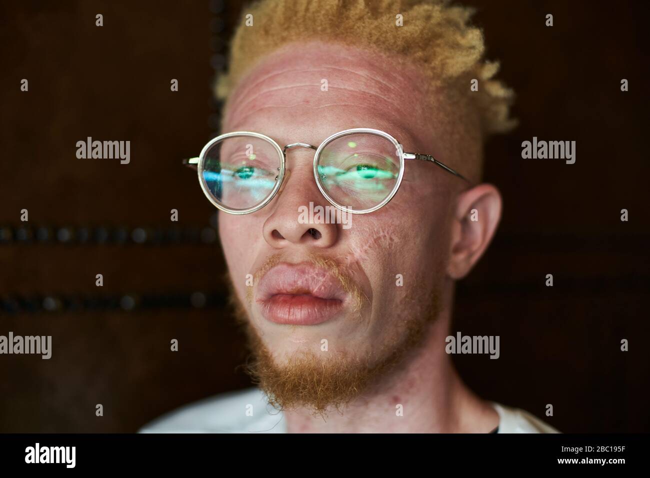 Portrait of an albino man with round glasses Stock Photo