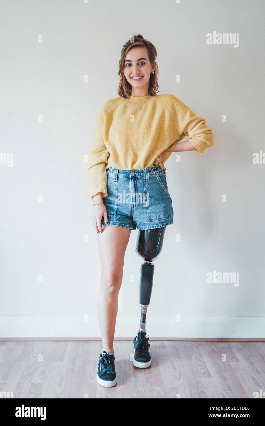 Portrait of smiling young woman with leg prosthesis Stock Photo