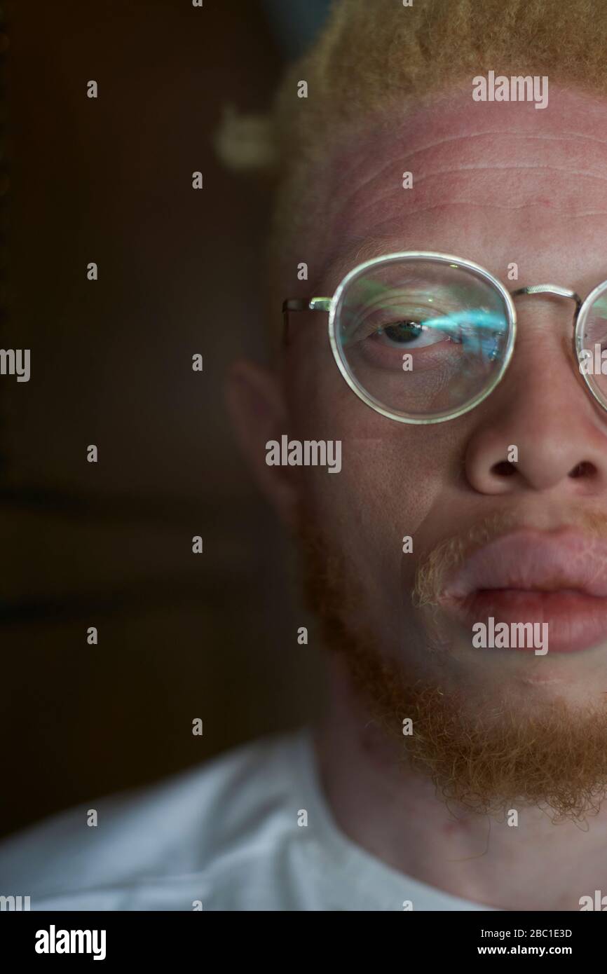 Half portrait of an albino man with round glasses Stock Photo