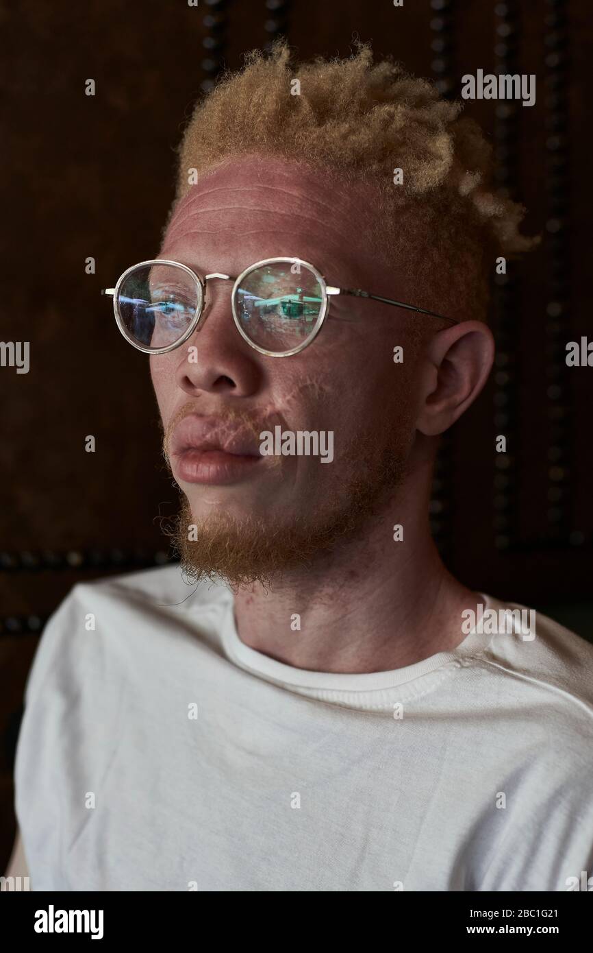 Albino man with round glasses looking sideways Stock Photo