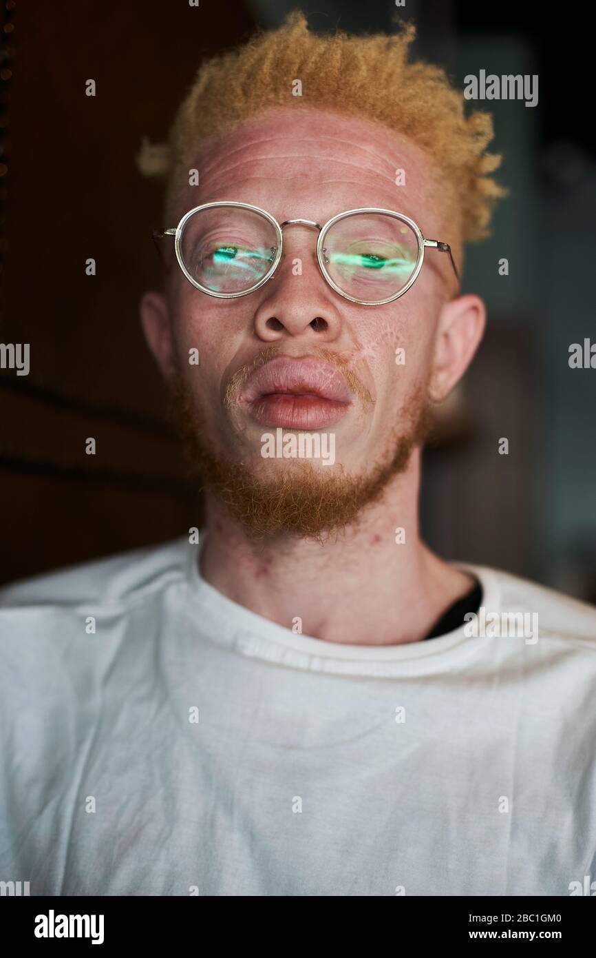 Portrait of an albino man with round glasses Stock Photo