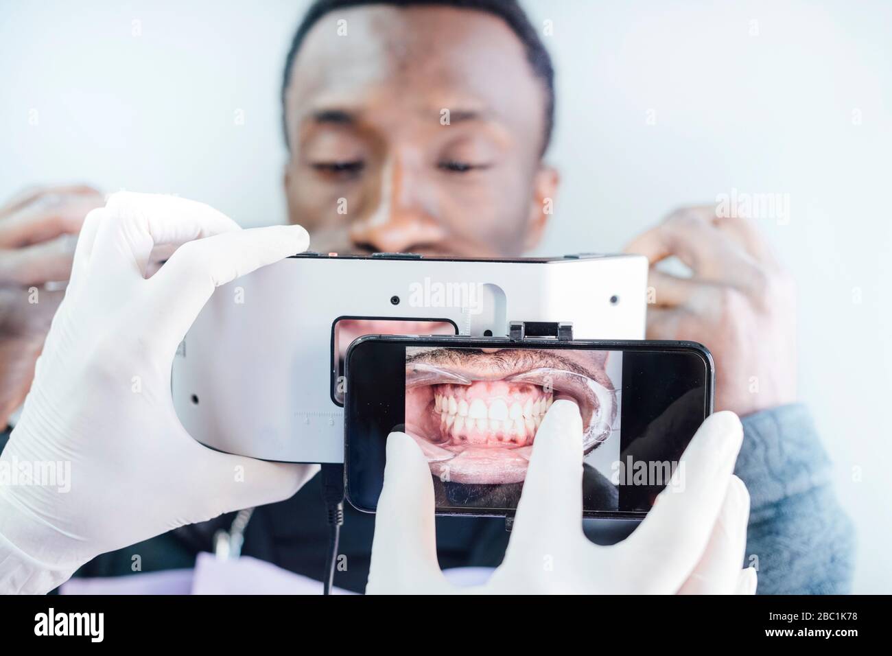 Dentist taking photo of teeth with special photographic apparatus Stock
