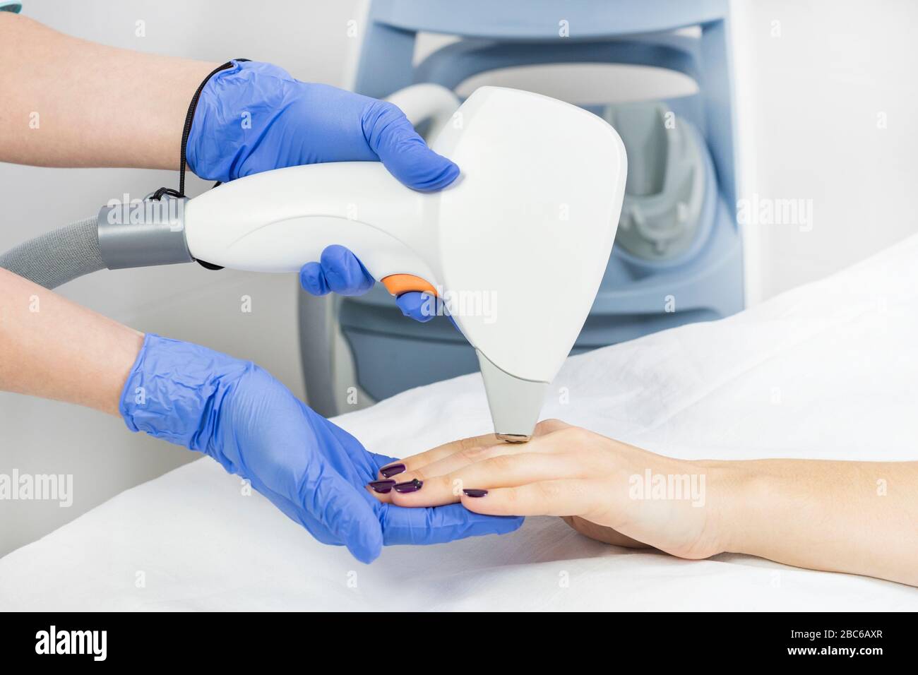 The procedure for depilation of female parts of the body with a laser ...