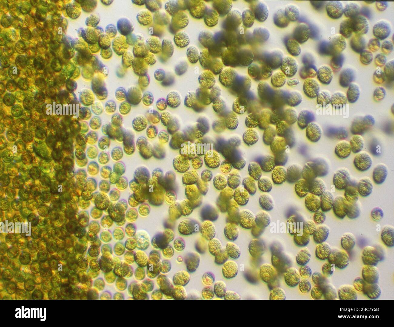 toxic gold algae in algal bloom under the microscope Stock Photo
