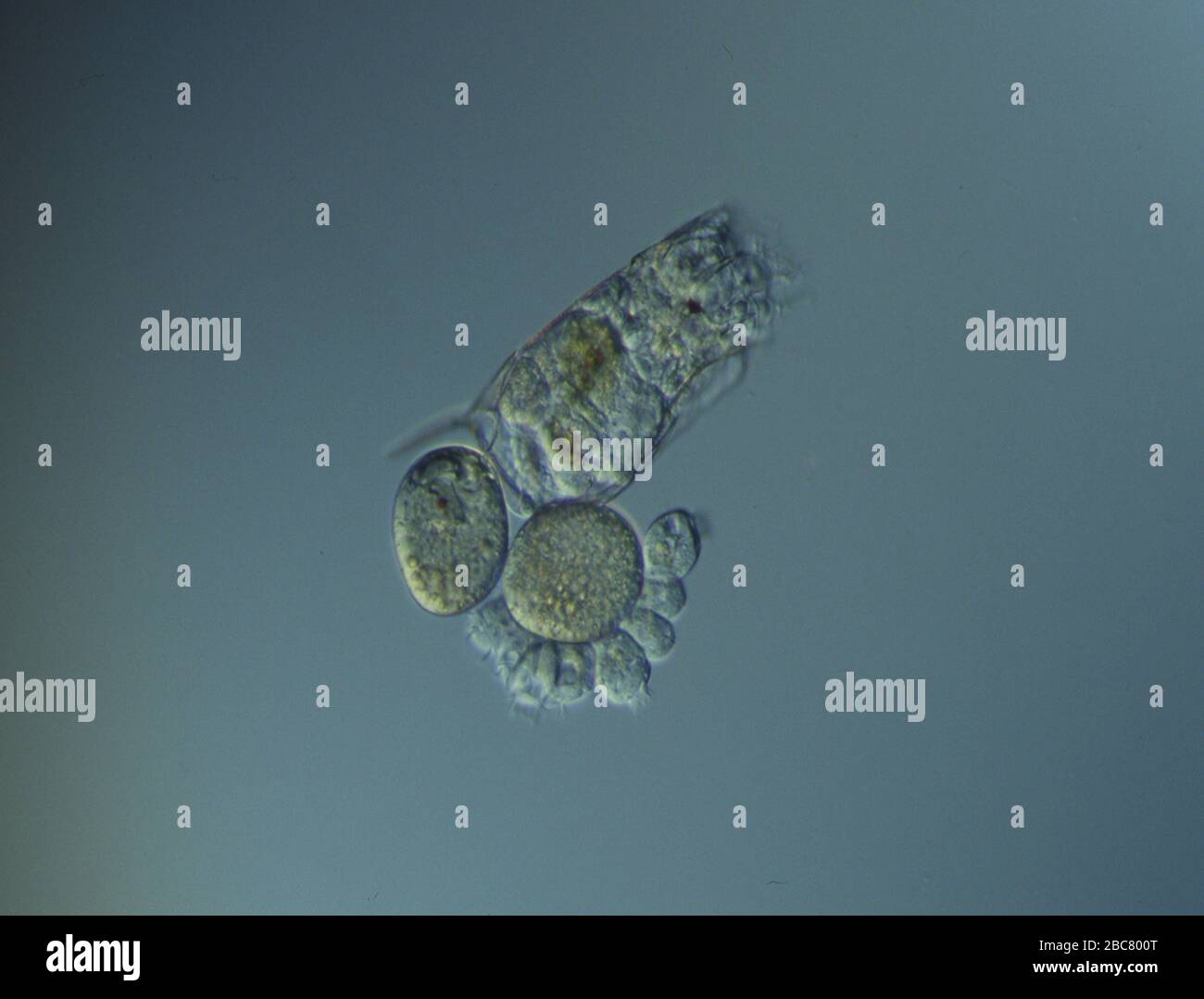 Rotifers swim in the water under the microscope Stock Photo Alamy