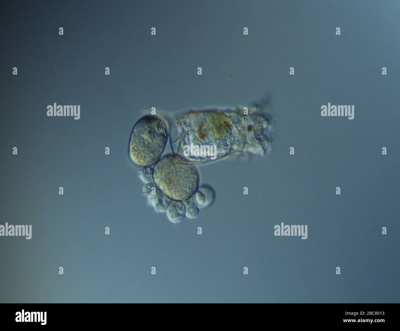 Bacteria microscope pond water hi-res stock photography and images - Alamy