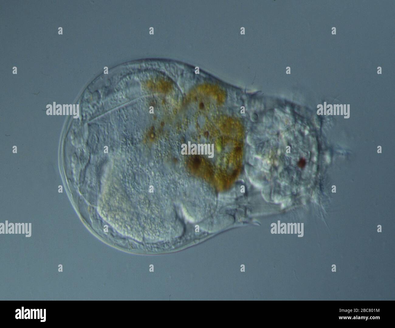 Rotifers swim in the water under the microscope Stock Photo Alamy